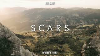 JEDAG JEDUG  Rawi Beat  Scars   New Remix [upl. by Lederer407]