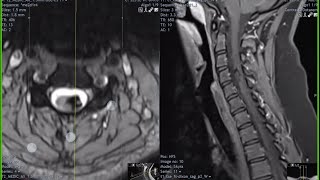 neuroradiology masterclass P2 [upl. by Celisse]