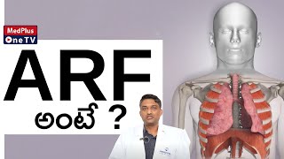 What is Acute Respiratory Failure   ARF Symptoms  DrRaja Manohar Acharyulu MedPlusONETV [upl. by Annairol]