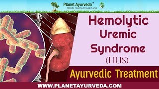 Ayurvedic Treatment of Hemolytic Uremic Syndrome HUS [upl. by Atteoj905]