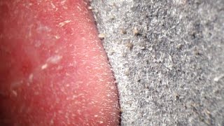 Pore Strips removal close up Blackheads removal [upl. by Wandie]