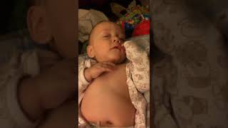 Example of Retractions Belly Breathing and Tachypnea in Infant [upl. by Eelynnhoj]