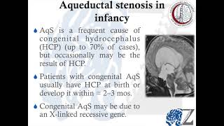 Aqueductal Stenosis ضيق القناة المائية [upl. by Sgninnej]