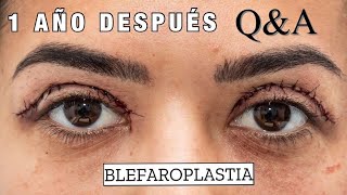 ME ARREPIENTO  Mi experiencia con la blefaroplastía 1 año después QampA [upl. by Nairehs]