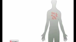 Transcutaneous Oximetry  Part 1  What We Are Measuring [upl. by Mixam]