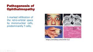 Graves Disease Arabic [upl. by Quintana882]