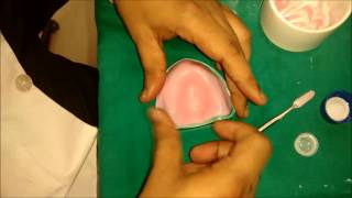 denture base preparation [upl. by Pomfret675]