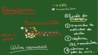 Degenerações Parte 1 Acúmulos Intracelulares  Resumo  Patologia [upl. by Bushweller]