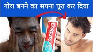 गोरा होने का तरीका Skin Whitening  Gora Hone Ka Tarika  Rang Gora Karne Ke Gharelu Upay [upl. by Nuncia]