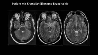 Keine Angst vor Röntgenbildern im Hammerexamen  Teil 2  DRG [upl. by Beret]