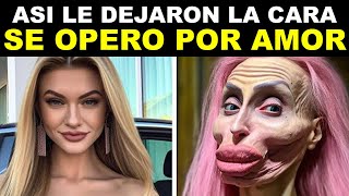 CELEBRIDADES Antes y Después de Cirujias Esteticas HORRIBLES [upl. by Mcclish]