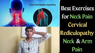 The Best Exercises for Cervical Radiculopathy [upl. by Jeanine]