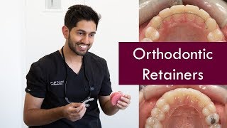 Do you really NEED to wear your Orthodontic Retainers  Dr Jiten Vadukul  The Orthodontist [upl. by Sammer]