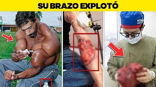 Estos Musculos Falsos Salieron Terriblemente Mal [upl. by Cesya]