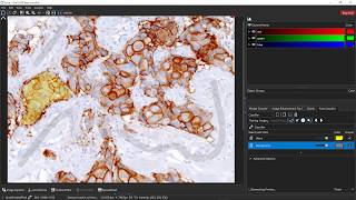 Fast trainable image enhancement of cancer regions histology [upl. by Yenrab]