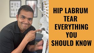 Hip Labrum Tears  Everything You Absolutely Need To Know [upl. by Anoiek364]