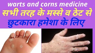 HOMEOPATHIC MEDICINE FOR WARTS AND CORNS सभी तरह के मस्से और ठेट से छुटकारा। [upl. by Gelb241]