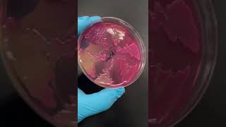 Acinetobacter baumannii is pretty 😊 [upl. by Averir]