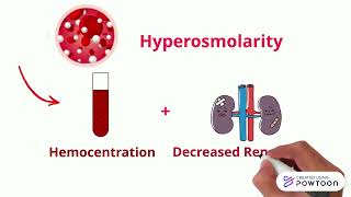 8 Hemoconcentration [upl. by Udell781]