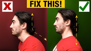 How to Fix Forward Head  Slumped Posture PERMANENTLY [upl. by Aronos827]