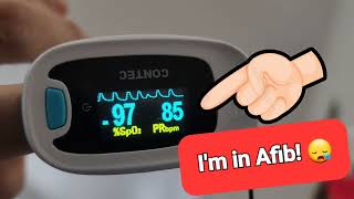 How my pulse oximeter tells me when I have Atrial fibrillation  aFib  AF  not a EKG or ECG [upl. by Eelah582]