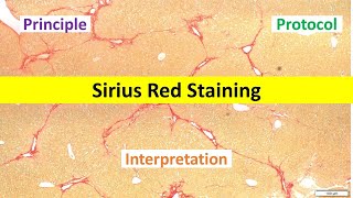 Picrosirius Red Staining [upl. by Javier311]