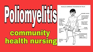 poliomyelitis in hindi  community health nursing  bsc nursing 2nd year [upl. by Vandervelde892]