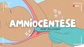 Amniocentèse [upl. by Nueormahc]