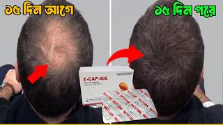 E Cap 400 চুলে ব্যবহার করার সঠিক নিয়ম 15 দিনেই রেজাল্ট 😱How To Use Vitamin E Capsule On Hair Bangla [upl. by Bard]