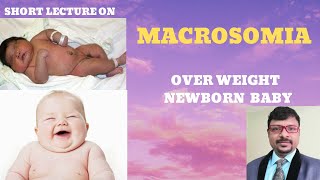 WHAT IS MACROSOMIA CAUSES OF OVER WEIGHT NEWBORN BABY FETAL MACROSOMIA [upl. by Halla]