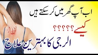 Allergy Treatment  skin allergy treatment at home  skin allergy ka ilaj  skin allergy itching [upl. by Erving]