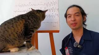 How to read hypokalemia on ECG [upl. by Bubalo558]