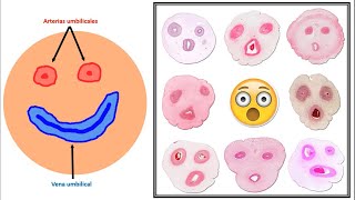 Histología del cordón umbilical junto con Dr Quetglas [upl. by Peedus]