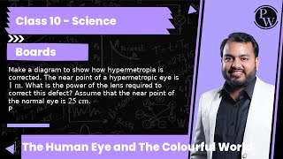 Make a diagram to show how hypermetropia is corrected The near point of a hypermetropic eye is 1 [upl. by Leasa]