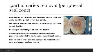 biomimetics2caries removal strategies [upl. by Hephzipah872]