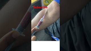 Blood Sample collection procedure aseptic techniques nursing medicalshorts injection neet2024 [upl. by Stricklan]