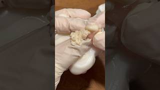 Mochi Pimple Popping pimplepopping satisfying visualasmr relax cats oddlysatisfying [upl. by Endor]