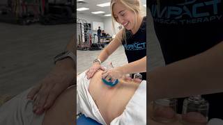 Benefits of Cupping cupping physicaltherapy physicaltherapist [upl. by Kalbli]