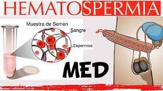 Hematospermia en menos de 2 minutos [upl. by Iow]