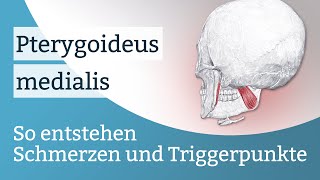 Pterygoideus medialis Schmerzen Triggerpunkte und deren Aktivierung [upl. by Harwill]