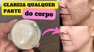 USE PARA CLAREAR MUITO A PELE ELIMINA MELASMA E PIGMENTAÇÃO  RECEITA CASEIRA [upl. by Phillipe]