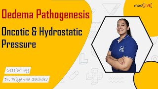 Oedema Pathogenesis  Oncotic amp Hydrostatic Pressure  Pathology  MedLive by Dr Priyanka Sachdev [upl. by Dnalrah]