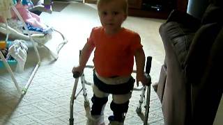 SPINA BIFIDA AVA GRACE WALKING WITH FULL LEG BRACES 2010 [upl. by Joice146]