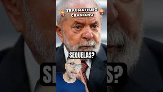 Traumatismo craniano de Lula VAI TER SEQUELAS [upl. by Odnamra]