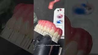 O NÍVEL QUE CHEGARAM AS PTS IMPRESSAS 🔥 exocad impressao3d shortsvideo cadista odontologia [upl. by Kloman]