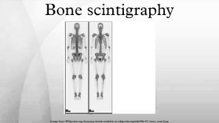 Bone scintigraphy [upl. by Maillij281]