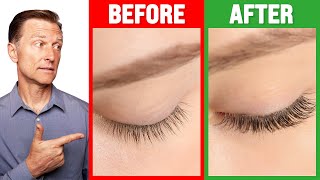 How to Grow Long Thick Eyelashes QUICKLY  Dr Berg [upl. by Eelyrehc]