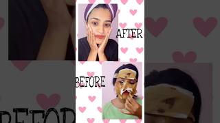 Black heads and white heads പറ പറക്കും Instant glowegg white coffee peel off mask beautyhacks [upl. by Gilges]