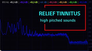 Relief Tinnitus with High Pitched Sounds  Tinnitus Retraining Therapy TRT [upl. by Leckie]