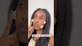 3minutes a day keeps the pimples away 🥰✨ fyp fypシ skincare acne pimple beauty [upl. by Letitia]